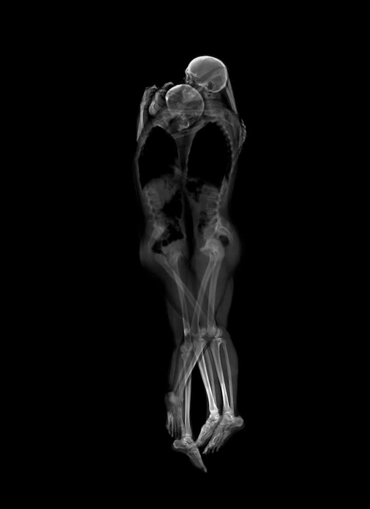 X-Ray photo of two people in close embrace. We see there skeletons against a black background.