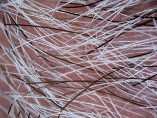 Photo showing that “grey” hair is a mix of individual strands that are either white or pigmented. 