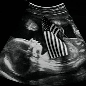 Progressives Can’t Bear Pregnancy