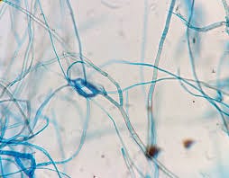 File:Fungal hyphae.jpg - Wikimedia Commons