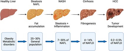 A gene based strategy to prevent NAFLD