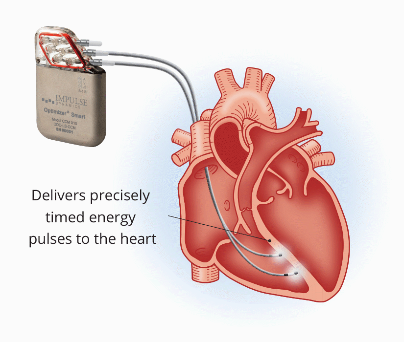 Nursing Resources - Impulse Dynamics