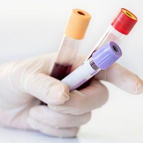 🗒 The Ultimate PCOS Lab Checklist