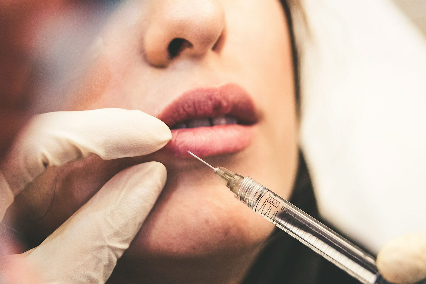 A close-up shot of a woman getting a lip injection A close-up shot of a woman getting a lip injection