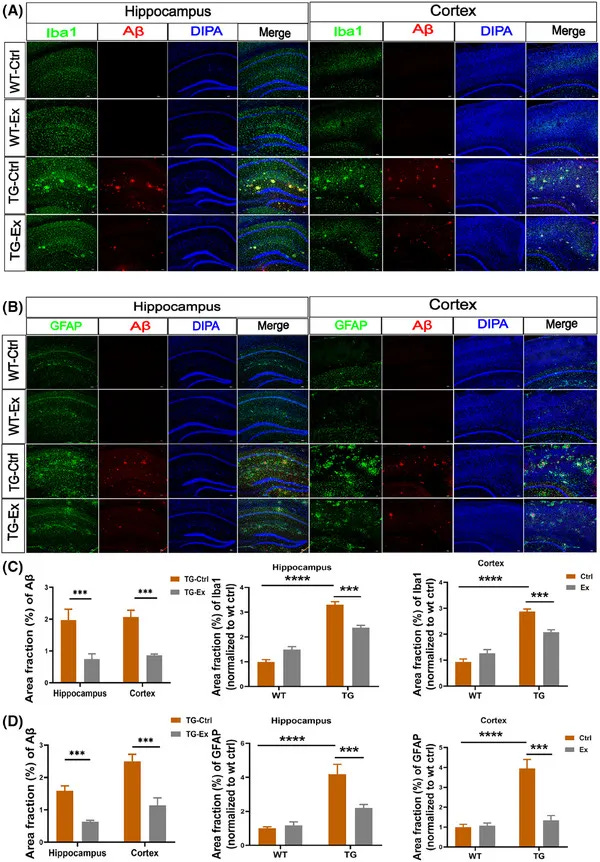 Exercise reduces neuroinflammation, Aβ plaque accumulation in the hippocampus and cortex of APPSWE/PS1dE9 mice. (Hu Y, et al. Voluntary wheel running exercise improves sleep disorder, circadian rhythm disturbance, and neuropathology in an animal model of Alzheimer’s disease. Alzheimers Dement. 2025) Exercise reduces neuroinflammation, Aβ plaque accumulation in the hippocampus and cortex of APPSWE/PS1dE9 mice. (Hu Y, et al. Voluntary wheel running exercise improves sleep disorder, circadian rhythm disturbance, and neuropathology in an animal model of Alzheimer’s disease. Alzheimers Dement. 2025)