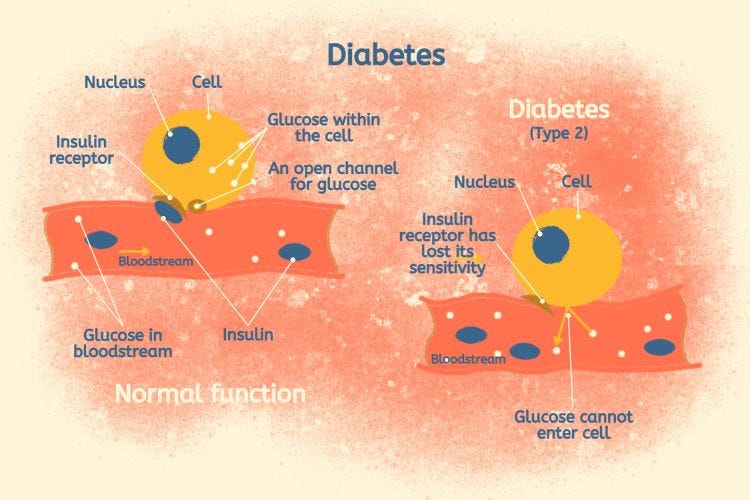 Type 2 Diabetes