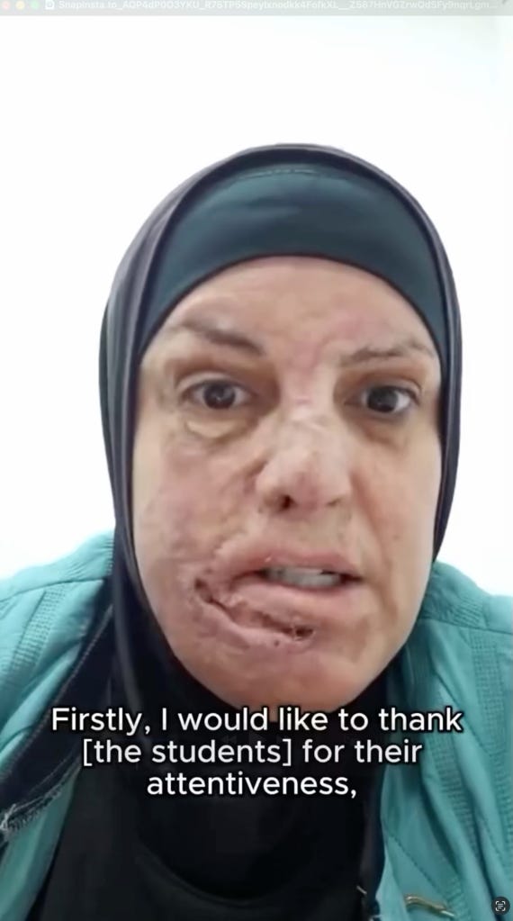 Israa Jaabis, convicted of attempted car bombing, speaks by video call.