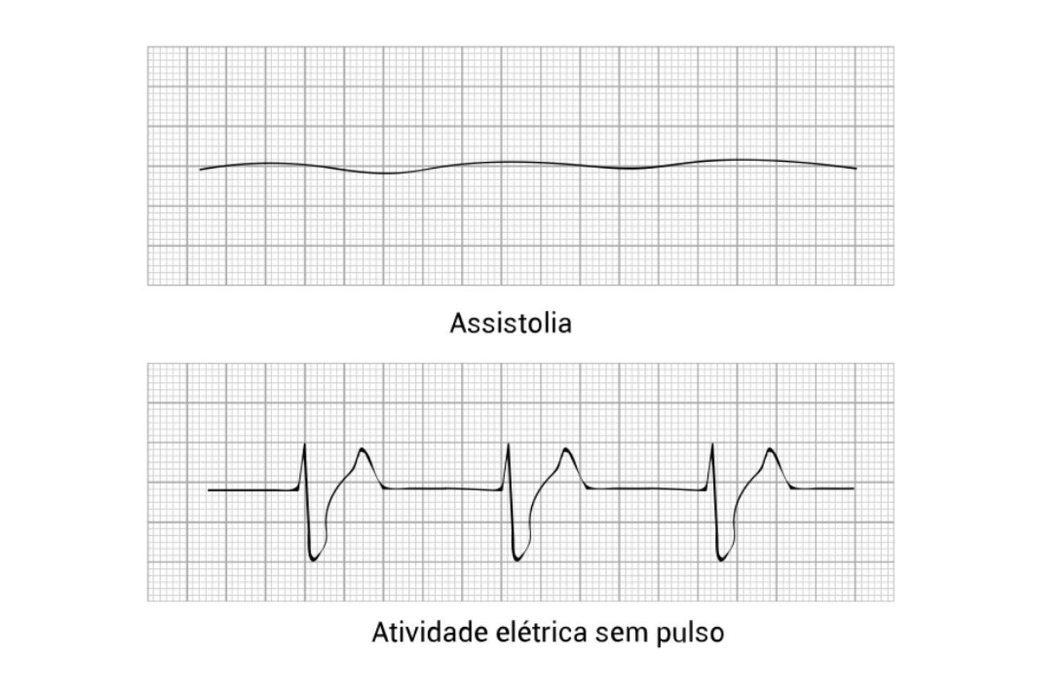 (Reprodução: VALEJO, 2005, adaptado)
