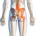 You Don't Have Sciatica.