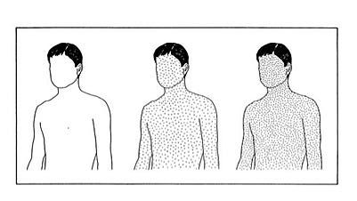 Text Box:  
Patterson’s figure from the NAS report showing the relative body burdens of lead in uncontaminated groups (left), present-day Americans (center), and lead-poisoned individuals.
