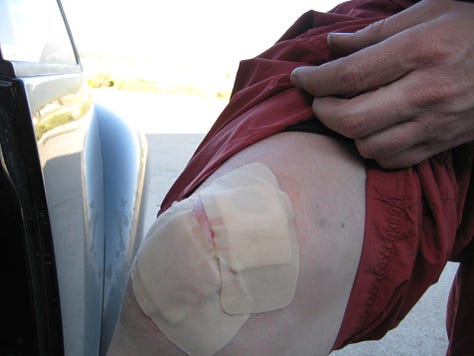 Last year’s ride? Oh, hands down, it was the champ of all road bike adventures. Might’ve been the gravel roads that made it feel like a throwback to the wild, wild west, allowing us to dust off those cross bikes with the knobby tires. Or, perhaps, it was that stroke of luck where I somehow, against all odds, ended up winning the race (let’s not talk about this year, shall we?). But you know what? The real cherry on top was the epic barbeque at Matt Seeley’s place afterwards. Nothing wraps up a day of pedaling like good company and even better BBQ.