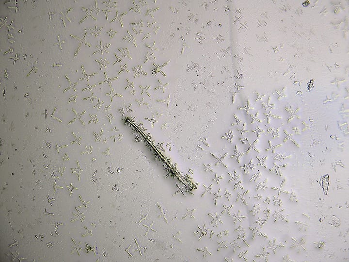 'Things' in urine sample.