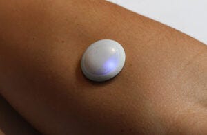 A photo of Biolinq’s glucose sensor patch on a patient's upper forearm with a color-changing indicator light.