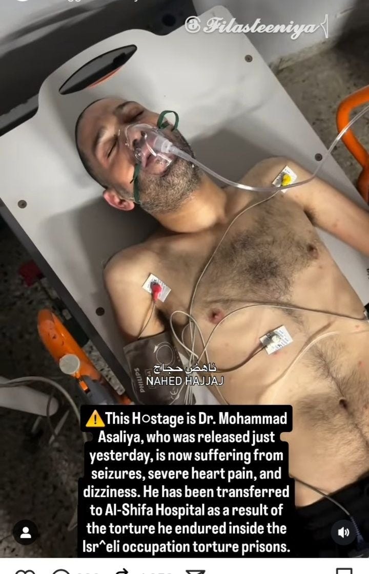 May be an image of ‎hospital and ‎text that says "‎C Filasteeniya حجاج ناهض NAHED HAJJAJ ! This Hostage is Dr. Mohammao Asaliya, who was released just yesterday, is now suffering from seizures, severe heart pain, and dizziness. He has been transferred to Al-Shifa Hospital as result of the torture he endured inside the Isr Isreli eli occupation torture prisons.‎"‎‎
