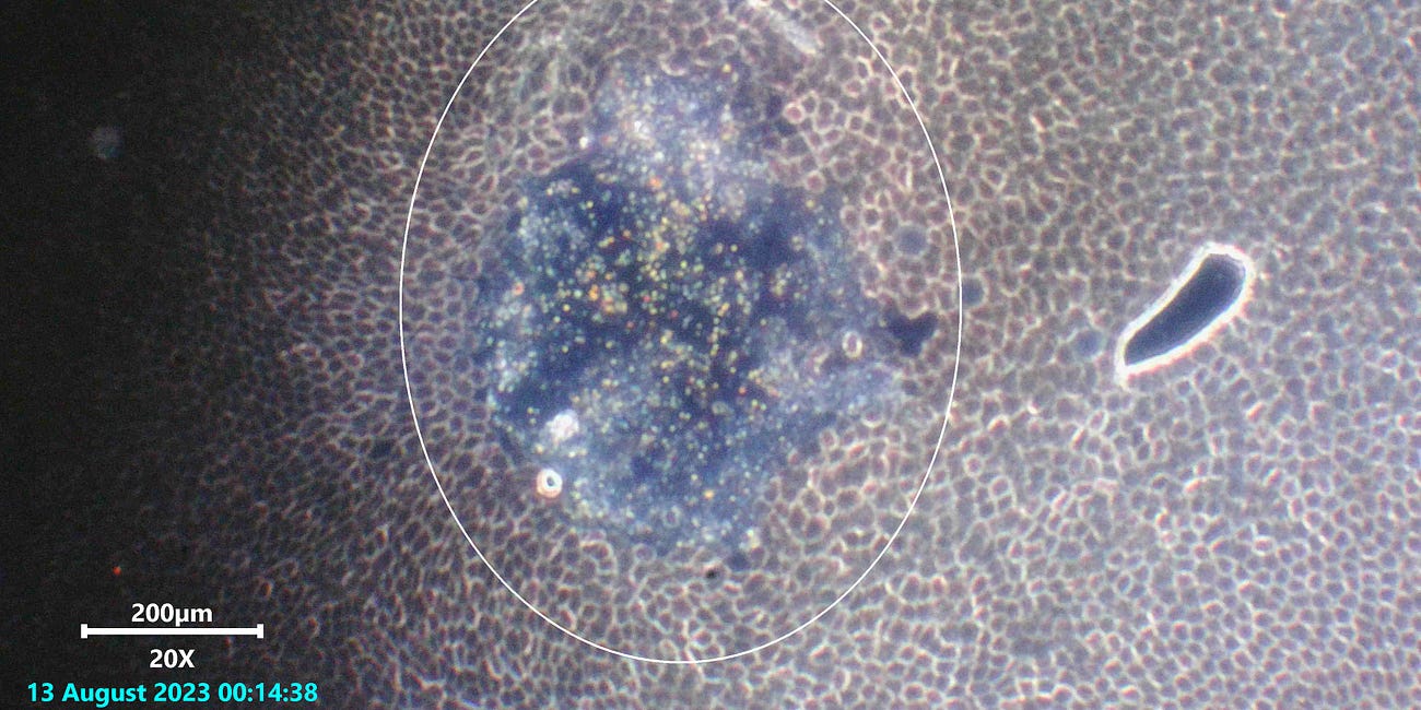 Q-Dots in blood suddenly from some source.