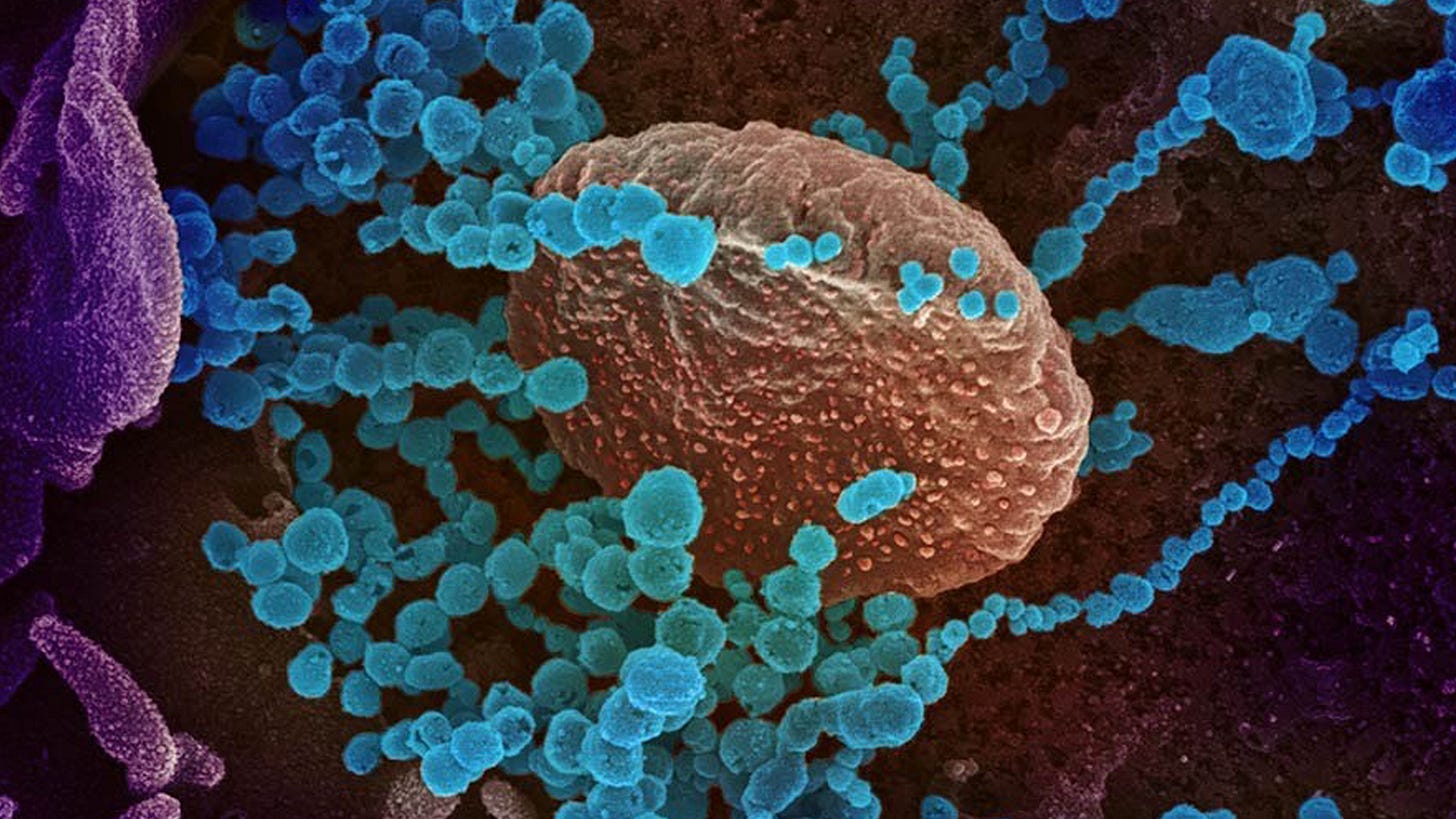 Stem cell transplant can treat type 2 diabetes - Healthcare Radius