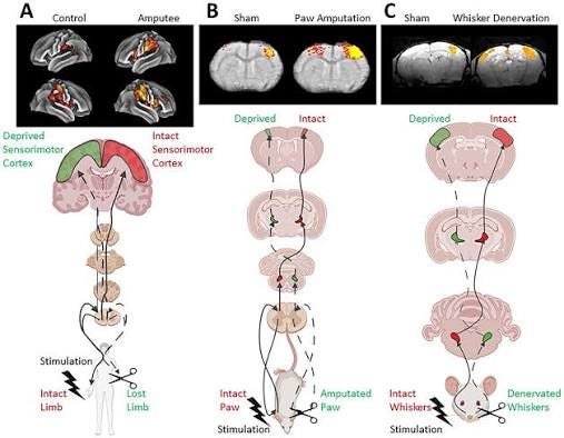 Cortical Reorganization after Limb Loss: Bridging the Gap between Basic Science and Clinical Recovery | Journal of Neuroscience Cortical Reorganization after Limb Loss: Bridging the Gap between Basic Science and Clinical Recovery | Journal of Neuroscience