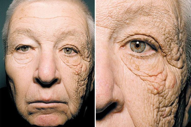This shocking picture of a truck driver shows what 28 years of sun damage  does to your face"