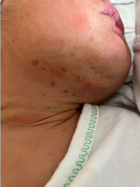 What's the diagnosis?