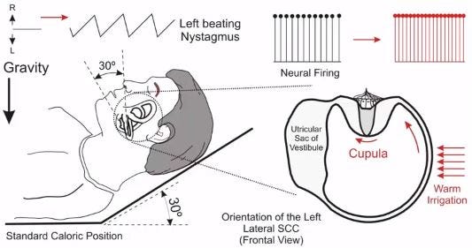 Caloric Test: A Deep Dive | Interacoustics