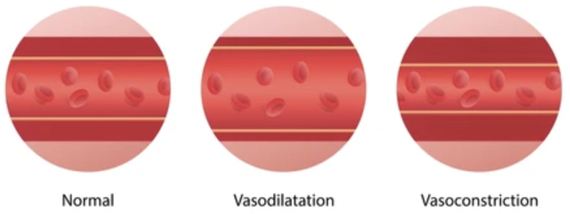 Vasodilation