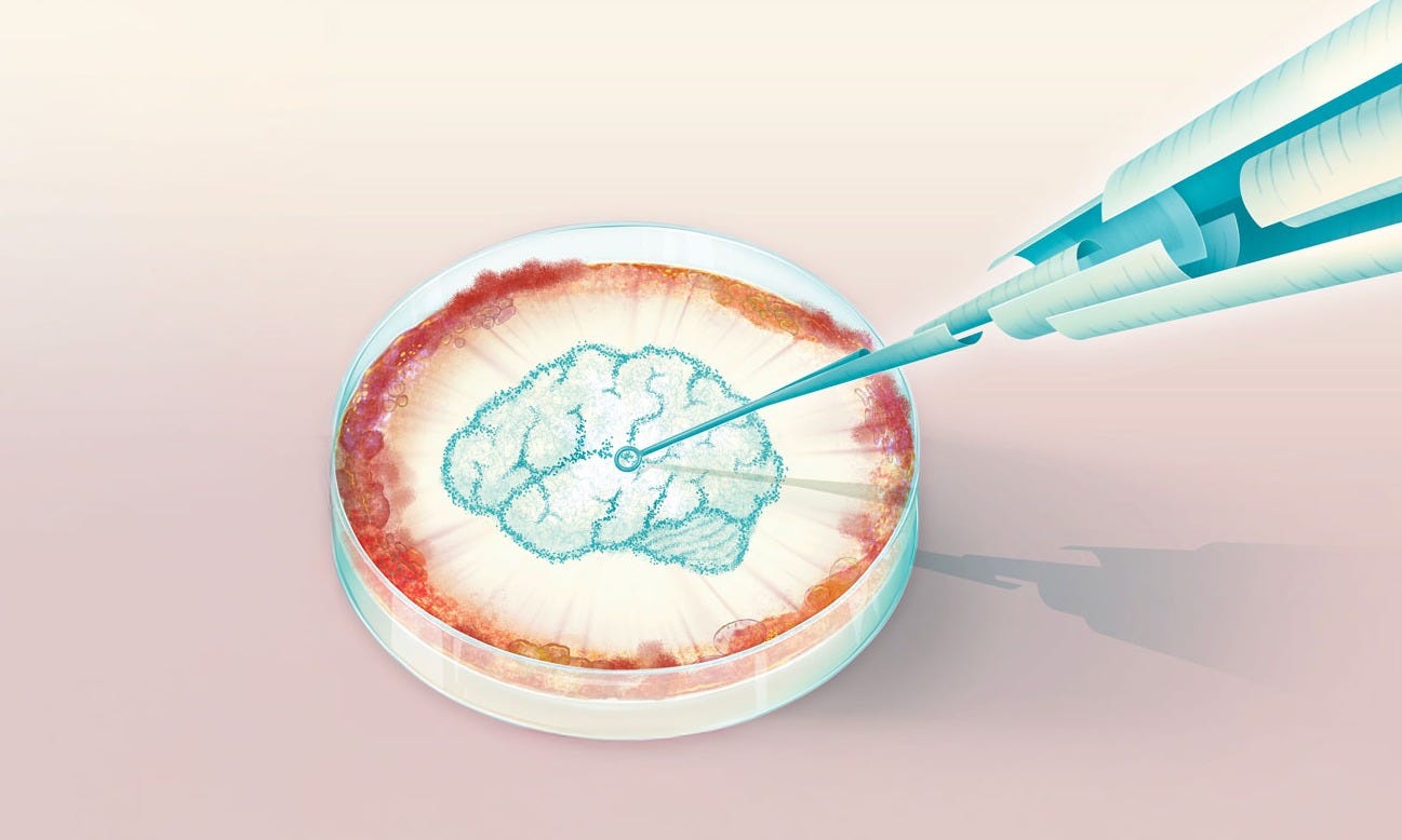 Conceptual illustration: An inoculation loop made of papers touching the surface of a petri dish, where microbes form the shape of a brain.