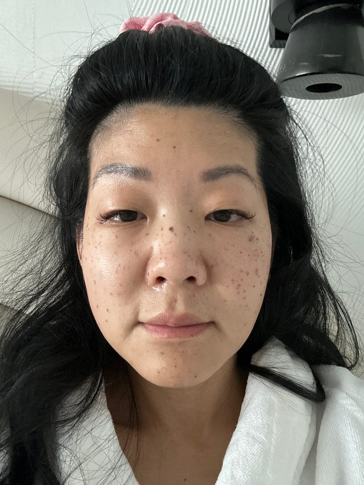 Michelle Lee after Korean skin clinic