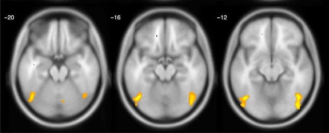 Brain scans