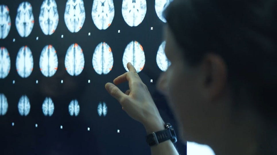 Does exercise affect how our brains respond to food cues? | Media Centre |  Loughborough University