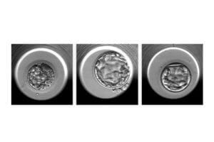 Examples of embryos evaluated by the STORK-A algorithm. From left to right, an embryo predicted to have a normal chromosome count or a single chromosomal abnormality; an embryo predicted to have a normal chromosome count; an embryo predicted to have more than one chromosomal abnormality.