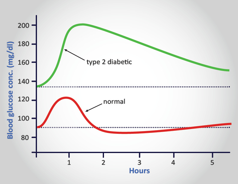 Diabetes Type 1 Type 2: A Comprehensive Guide - The Medical Biochemistry Page