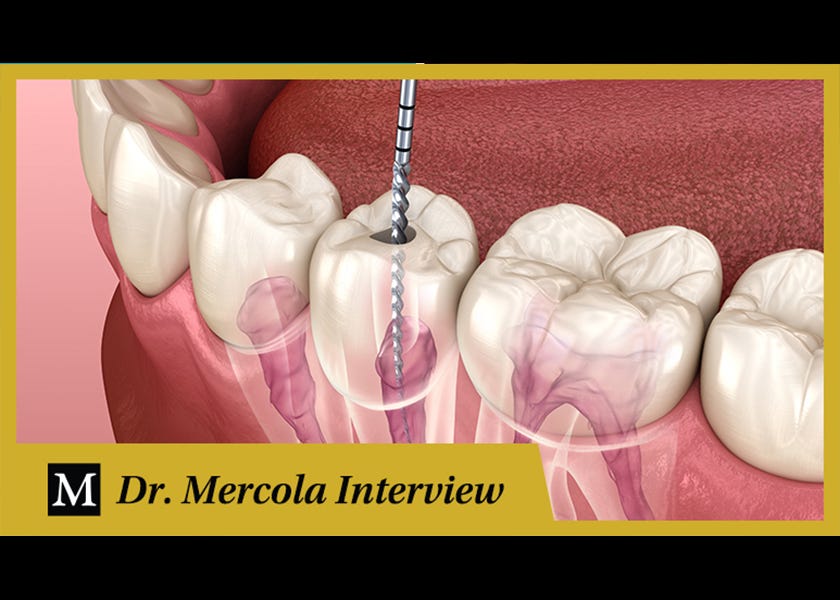 The Dangers of Root Canals and How to Treat Them