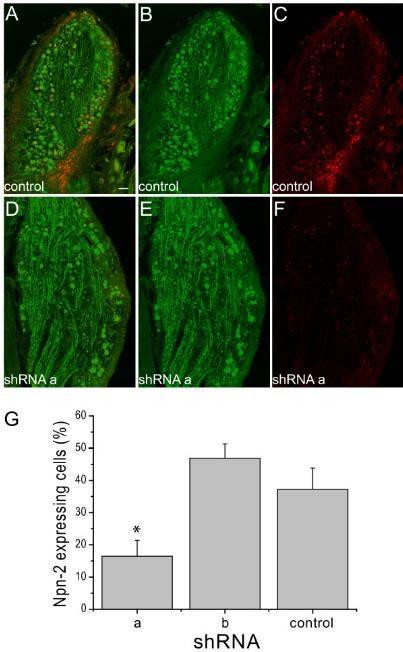 ehlertrnainpn2