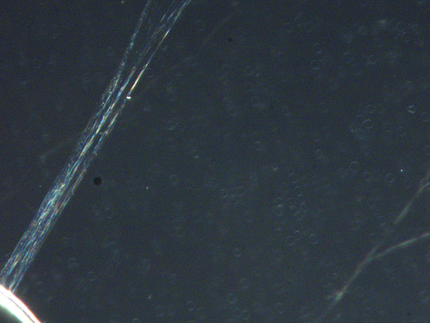 More of the structures that concentrated from blood into the H202