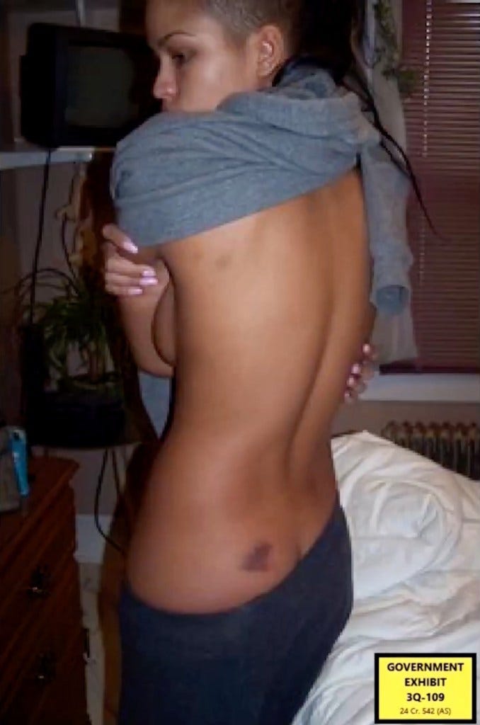 pics of cassie's injuries pics of cassie's injuries