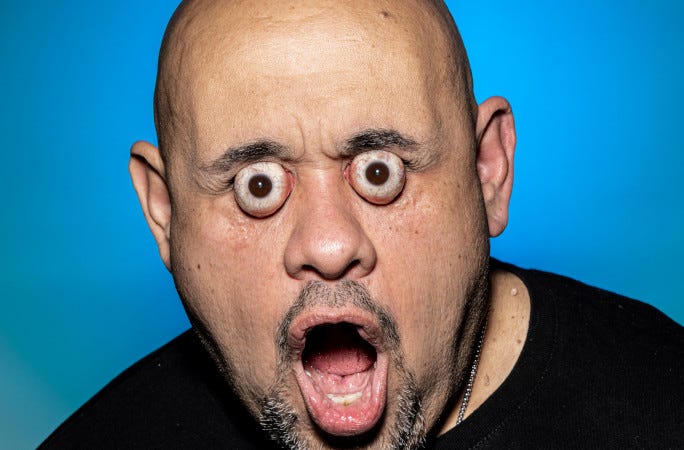This man's enormous orbs got him a jaw-dropping record title for ... This man's enormous orbs got him a jaw-dropping record title for ...