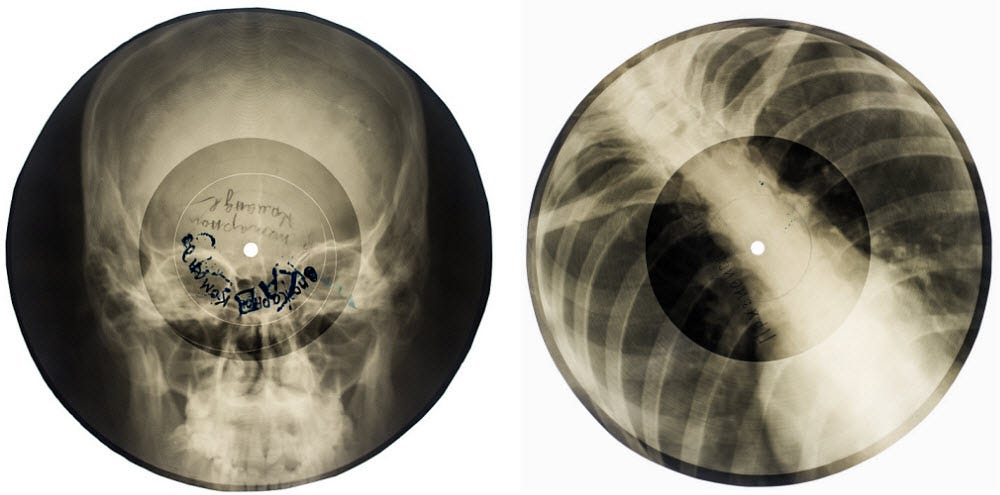 bone-record-1