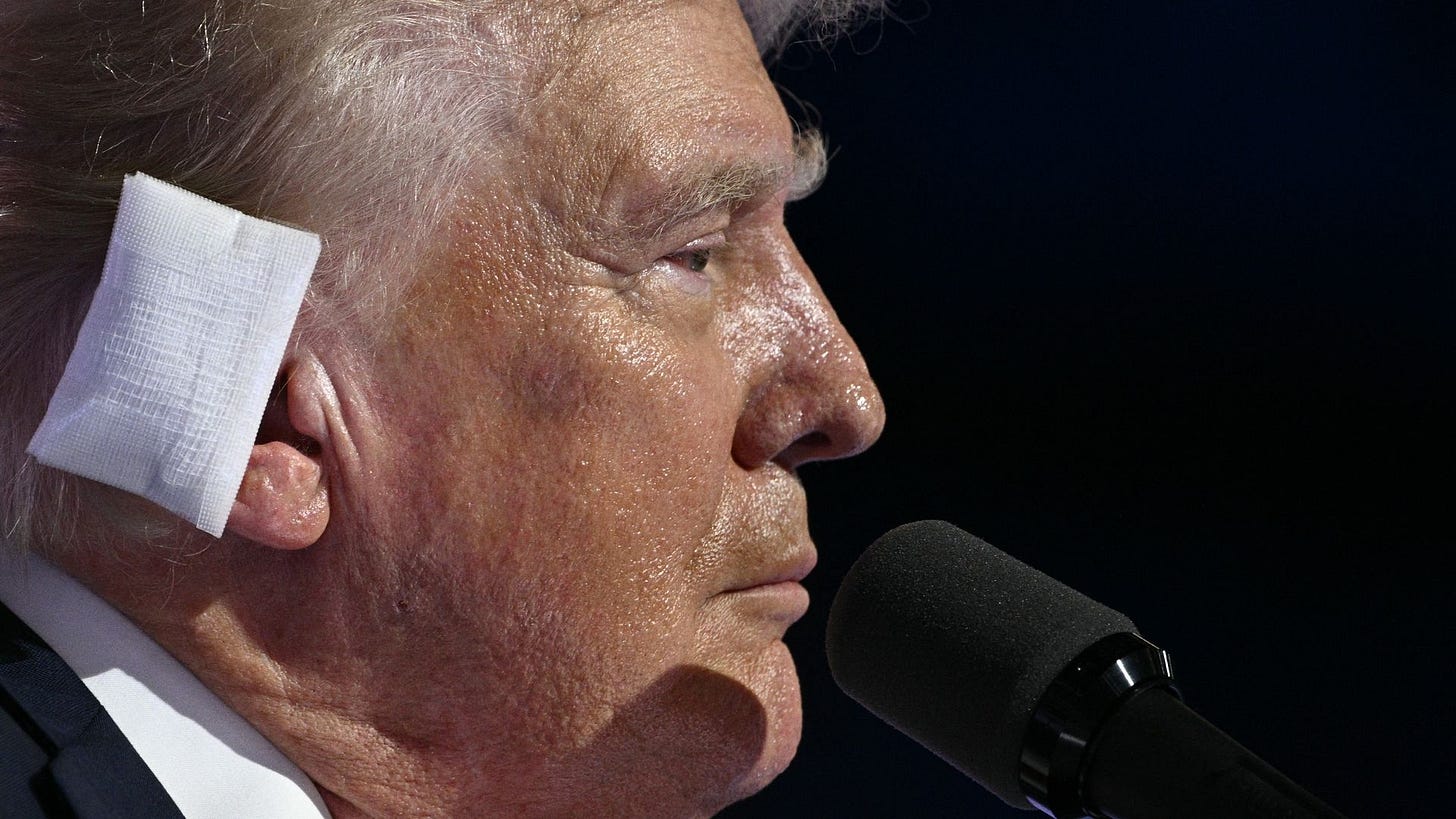Close-up side profile photo of former President Trump, whose ear is covered in a white dressing.