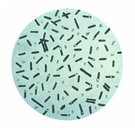 Clostridium botulinum - A circle with a lot of black and white objects in it