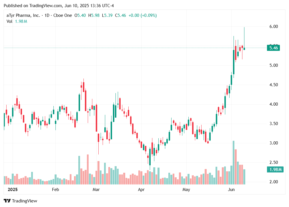 TradingView chart TradingView chart
