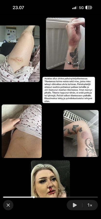Tilanteen väitetty suomalainen naisuhri on julkaissut kuvia mustelmista ja verisestä nenästä, jotka ovat väitetysti Noorin, SDP:n kunnanvaltuutetun ja Rantaperkiön Työväenyhdistys ry:n jäsenen, tekemiä.