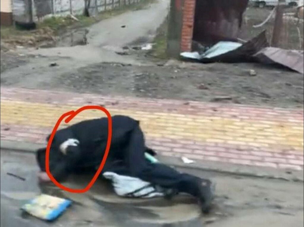 Bucha. Notice the White Armband. A pro-Russian civilian killed by the Azovs and blamed on the Russians Bucha. Notice the White Armband. A pro-Russian civilian killed by the Azovs and blamed on the Russians