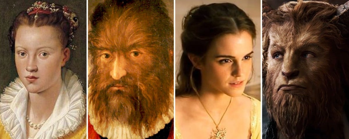 Photos of the Real Beauty and the Beast and Their “Beast” Children | by  Linda Caroll | History, Mystery & More | Medium