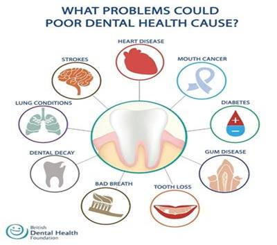 Poor dental health Poor dental health