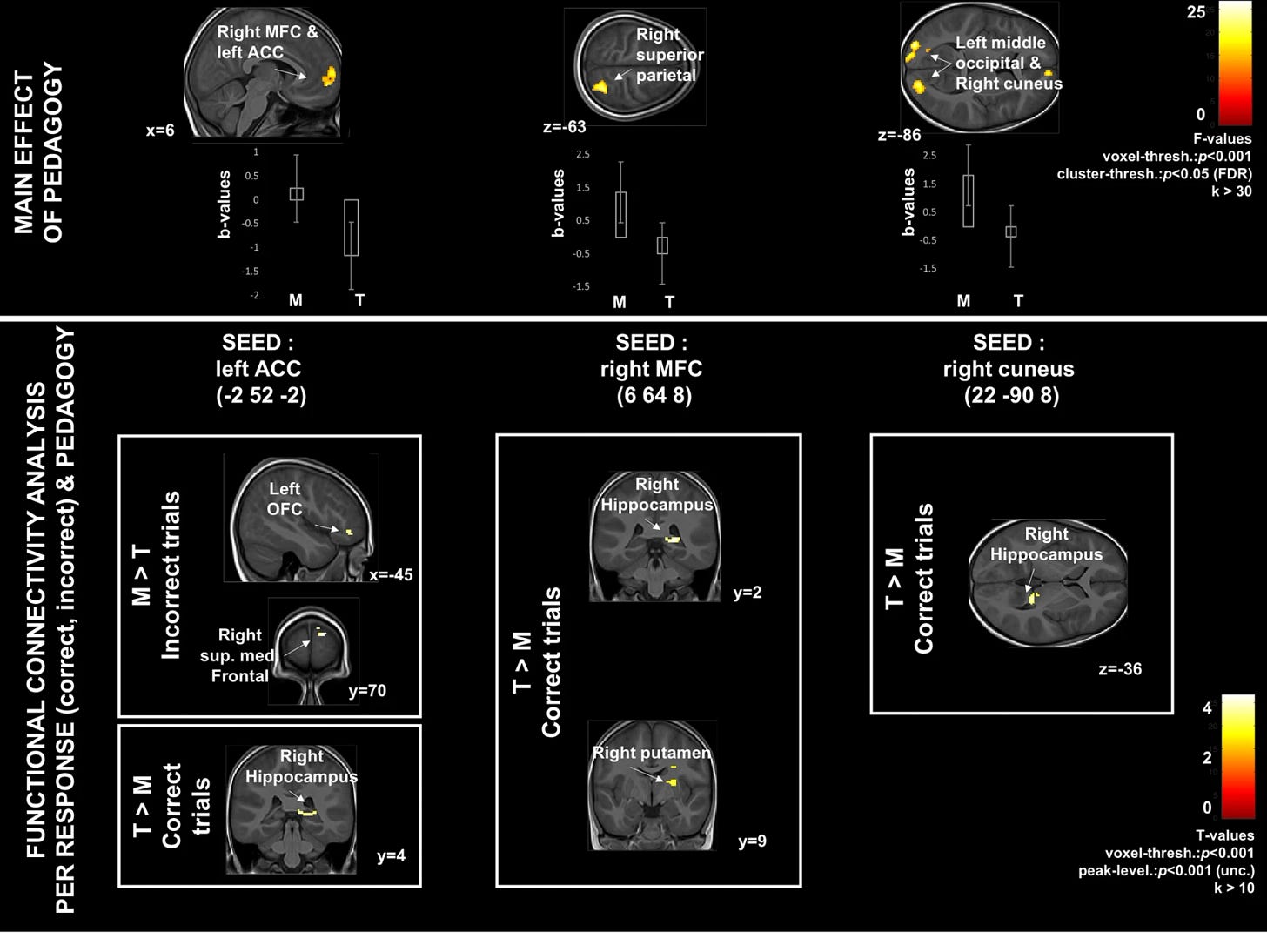 Figure 2. Differences in How Montessori Children (M) and Children in Traditional Education (T) Use Their Brains. 