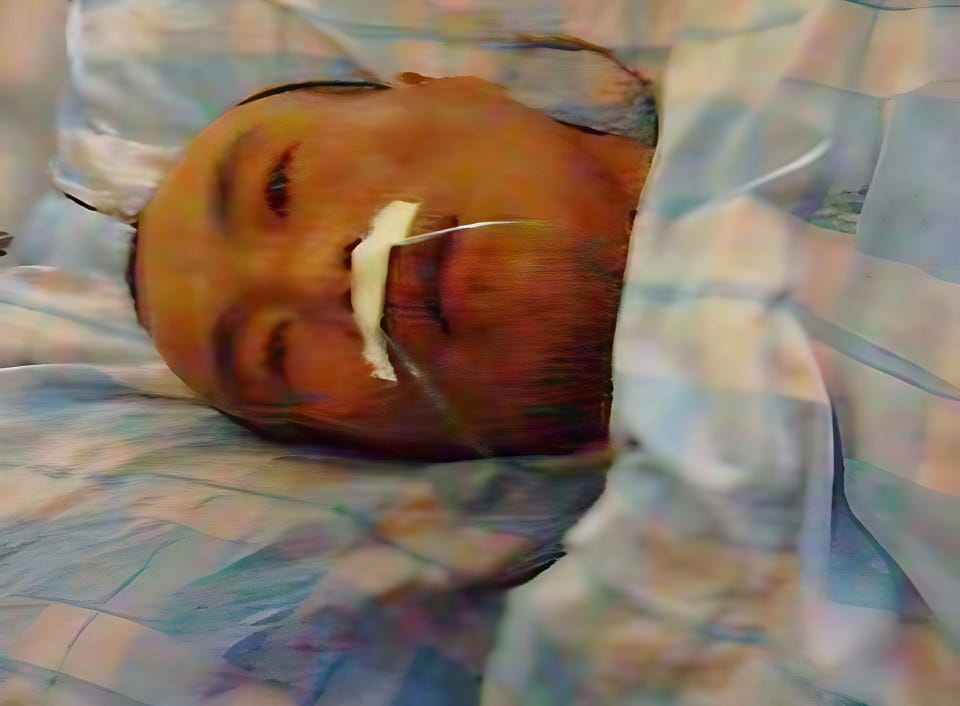 Illustration of a person lying in a bed with a nasal cannula. Illustration of a person lying in a bed with a nasal cannula.