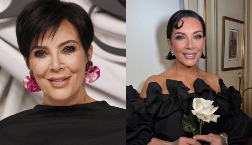 Kris Jenner, antes e depois: qual cirurgia fez a mulher de ...