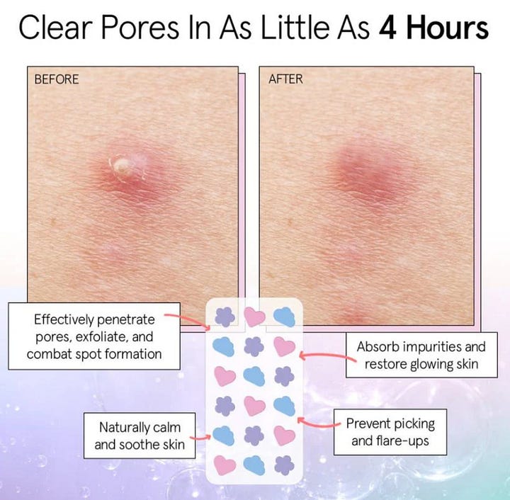 Grace & Stella pimple patches product infographic detailing power-packed ingredients including Hydrocolloid, Salicylic Acid, and Tea Tree Oil next to a real-skin before and after comparison showing reduced acne inflammation and spot formation.