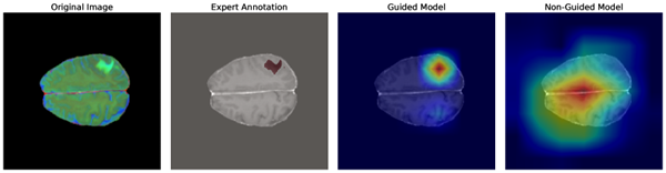Explainable AI: Grad-CAM Step-By-Step - by ANTHONY DEMEUSY