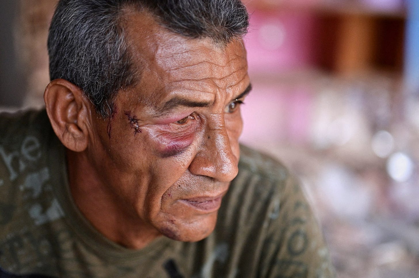 Aftermath of U.S. strikes in Venezuela